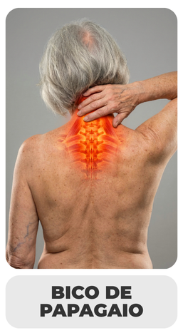 BICO-DE-PAPAGAIO.png