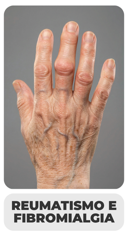 REUMATISMO-E-FIBROMIALGIA.png